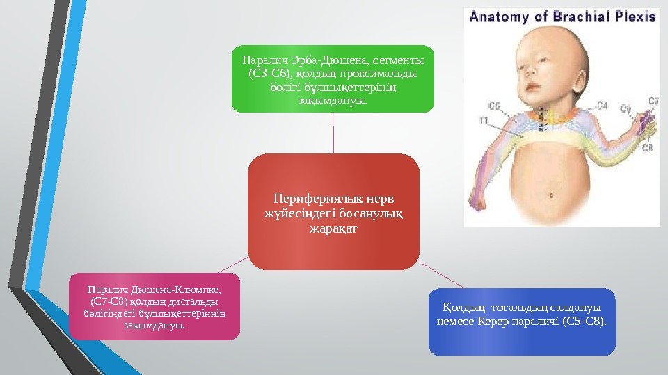 Перифериялы нерв қ ж йесіндегі босанулы  ү қ жара ат қПаралич Эрба-Дюшена, сегменты