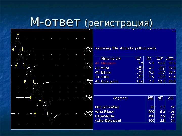 М-ответ (регистрация) 