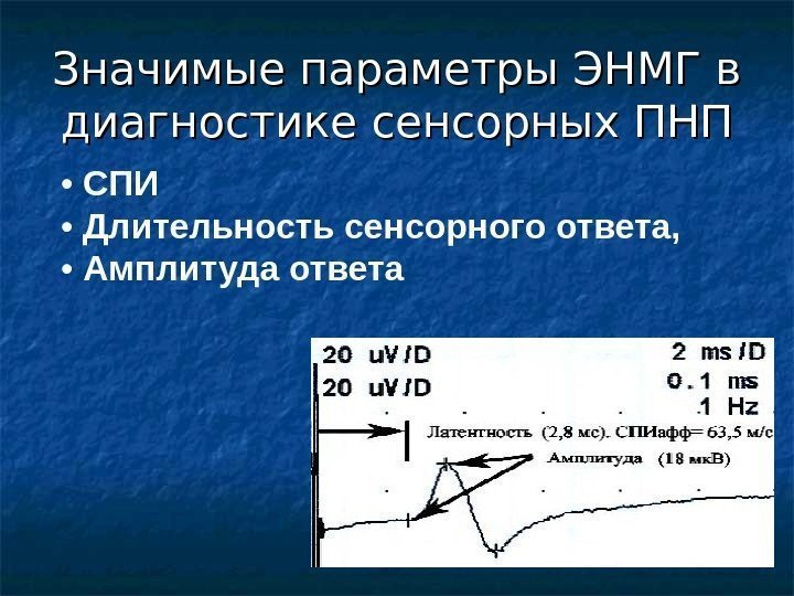 Значимые параметры ЭНМГ в диагностике сенсорных ПНП •  СПИ •  Длительность сенсорного