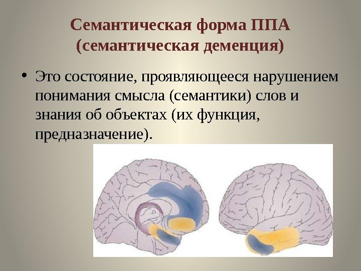 Семантическая форма ППА (семантическая деменция) • Это состояние, проявляющееся нарушением понимания смысла (семантики) слов