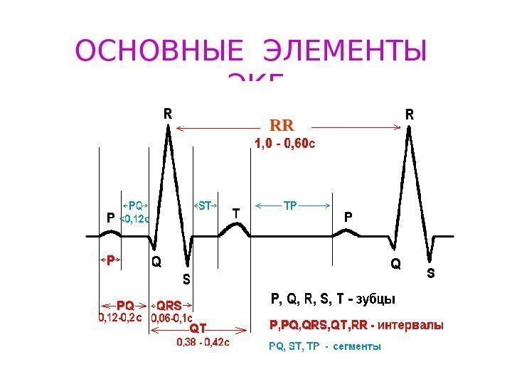   ОСНОВНЫЕ ЭЛЕМЕНТЫ  ЭКГ  RR 