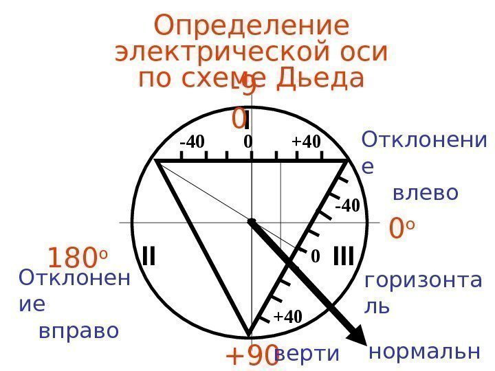   Определение электрической оси по схеме Дьеда  I II   