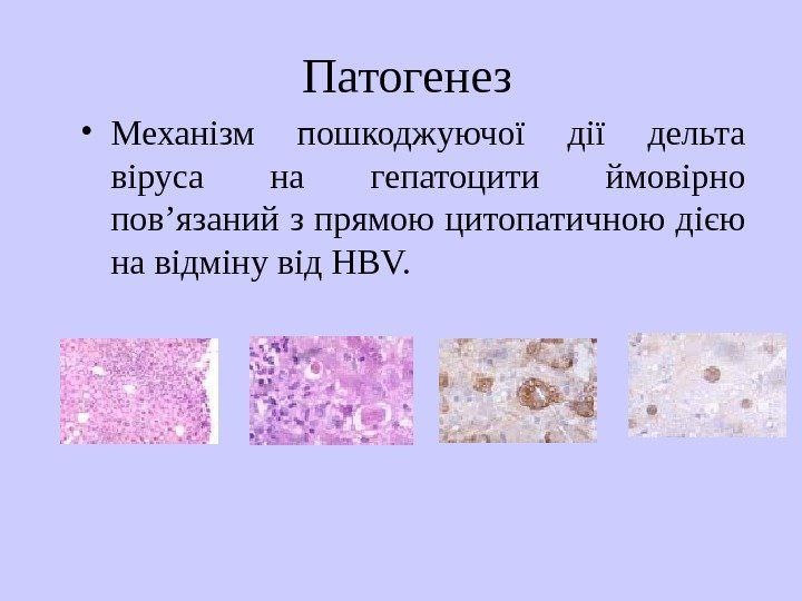   Патогенез • Механізм пошкоджуючої дії дельта віруса на гепатоцити ймовірно пов’язаний з
