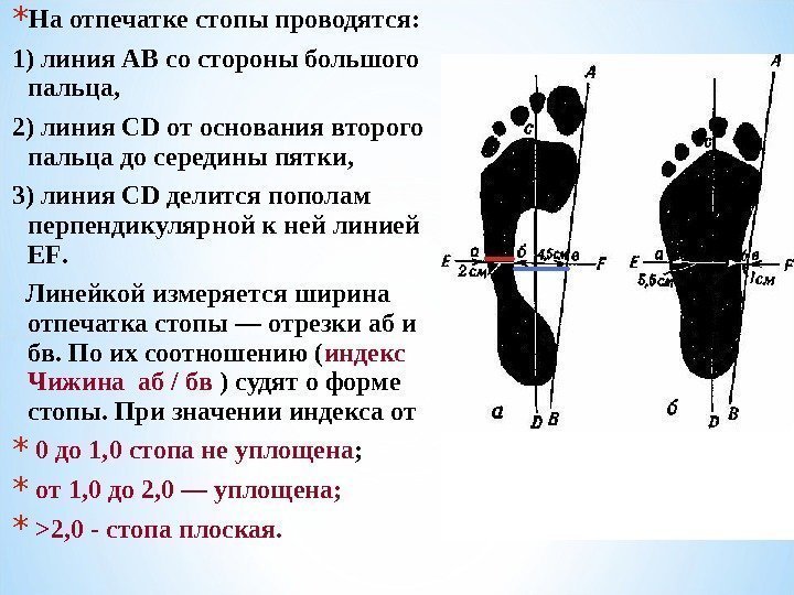 * На отпечатке стопы проводятся: 1) линия АВ со стороны большого пальца,  2)