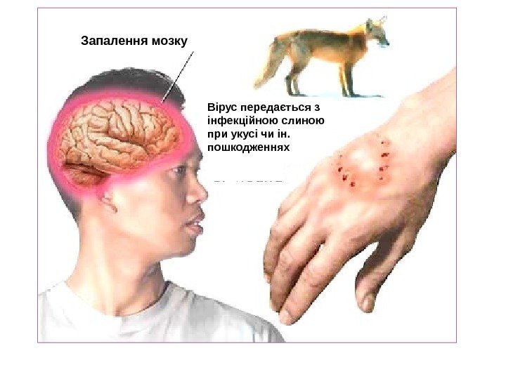   Запалення мозку Вірус передається з інфекційною слиною при укусі чи ін. 