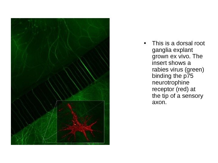  • This is a dorsal root ganglia explant grown ex vivo. The insert
