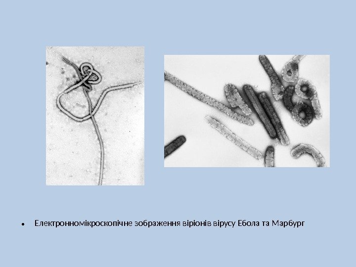  • Електронномікроскопічне зображення віріонів вірусу Ебола та Марбург 