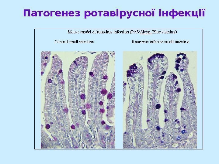 Патогенез ротавірусної інфекції 