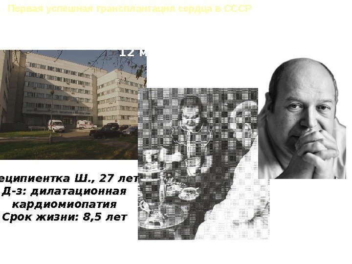   Первая успешная трансплантация сердца в СССР Реципиентка Ш. , 27 лет Д-з: