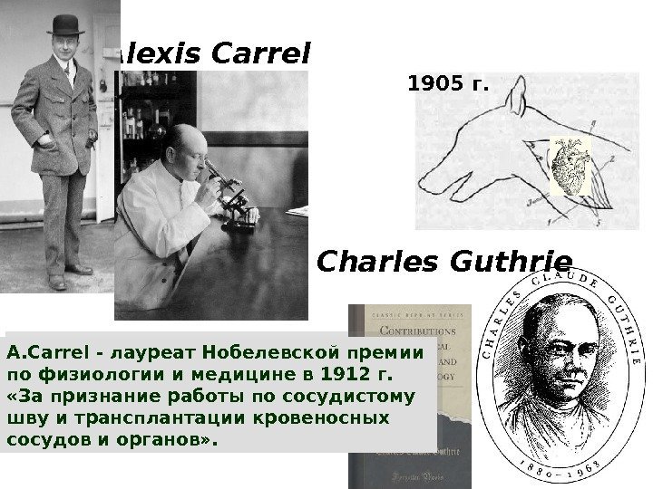 Начало XX века, США Alexis Carrel 190 5  г. Гетеротопическая ТС Charles Guthrie