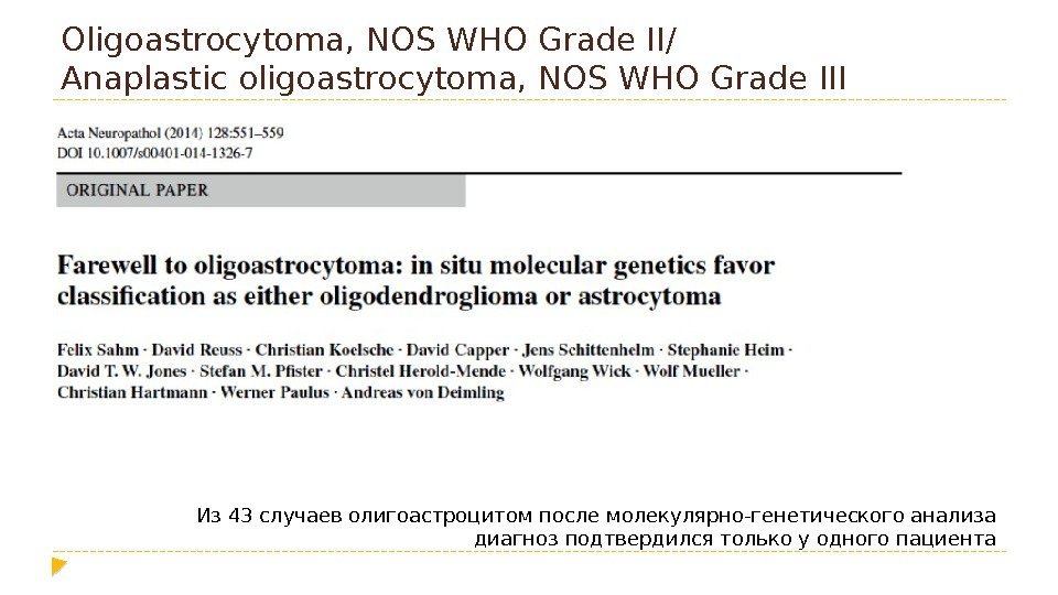 Oligoastrocytoma, NOS WHO Grade II/ Anaplastic oligoastrocytoma, NOS WHO Grade III Из 43 случаев
