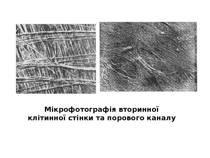 Мікрофотографія вторинної клітинної стінки та порового каналу 