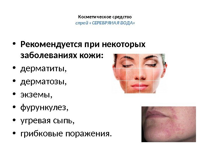 Косметическое средство  спрей «СЕРЕБРЯНАЯ ВОДА»  • Рекомендуется при некоторых заболеваниях кожи: •