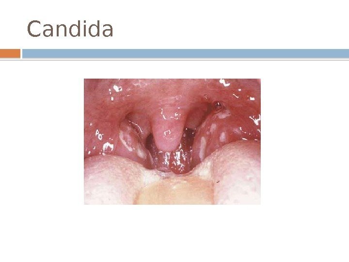 Candida 