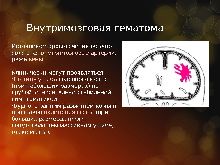 Внутримозговая гематома Источником кровотечения обычно являются внутримозговые артерии ,  реже вены.  Клинически