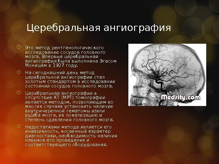 Церебральная ангиография Это метод рентгенологического исследование сосудов головного мозга. Впервые церебральная ангиография была выполнена