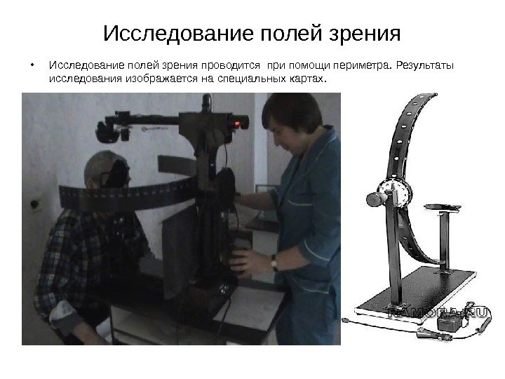 Исследование полей зрения • Исследование полей зрения проводится при помощи периметра. Результаты исследования изображается