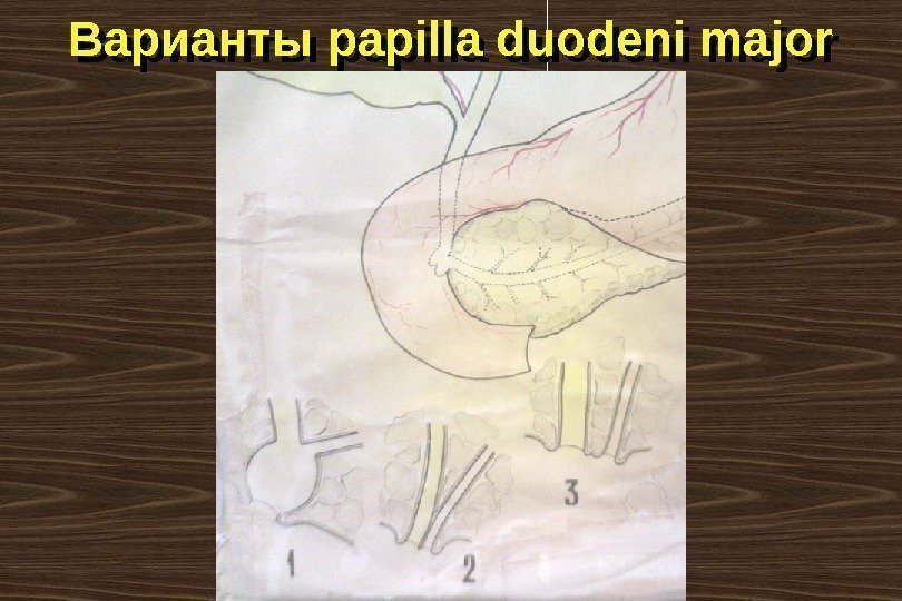 Варианты papilla duodeni major 