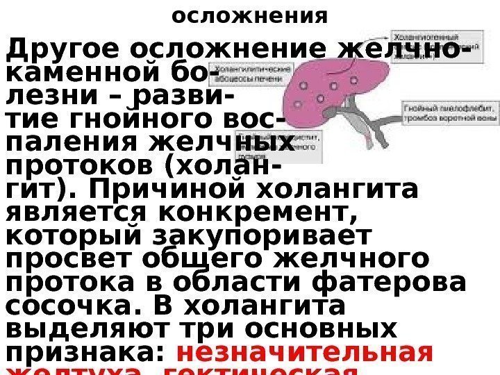 осложнения Другое осложнение желчно- каменной бо- лезни – разви- тие гнойного вос- паления желчных