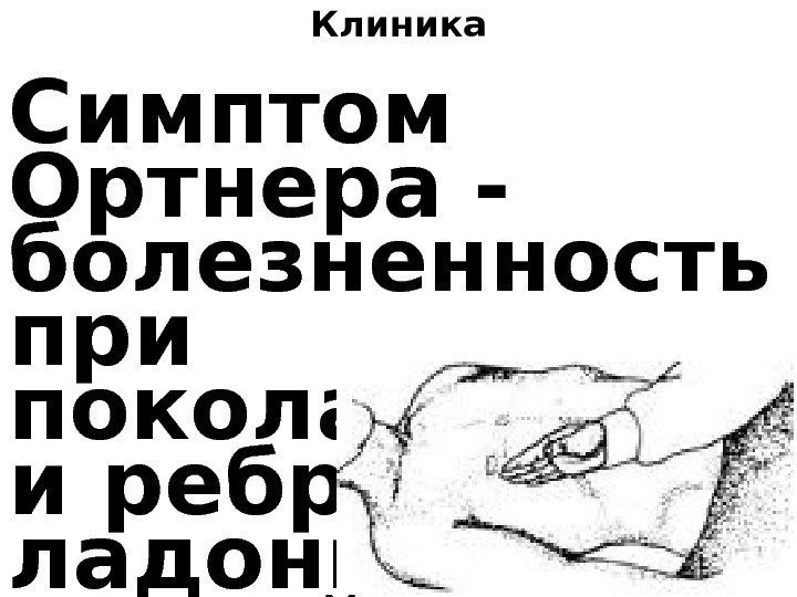 Клиника Симптом Ортнера - болезненность при поколачивани и ребром ладони по правой ребер- ной