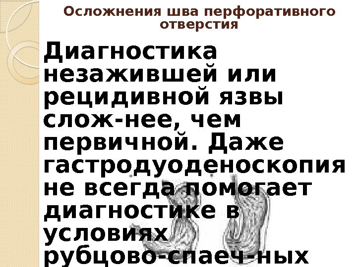 Осложнения шва перфоративного отверстия Диагностика незажившей или рецидивной язвы слож-нее, чем первичной. Даже гастродуоденоскопия