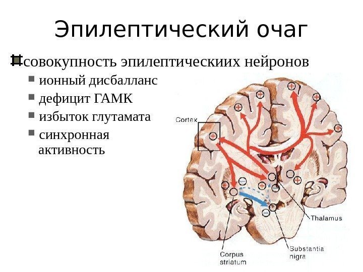 Эпилептический очаг совокупность эпилептическиих нейронов ионный дисбалланс дефицит ГАМК избыток глутамата синхронная активность 