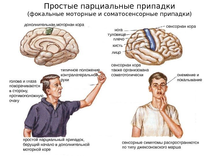 Простые парциальные припадки (фокальные моторные и соматосенсорные припадки) дополнительная моторная кора сенсорная кора нога