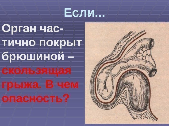 Если. . . Орган час- тично покрыт брюшиной – скользящая грыжа. В чем опасность?