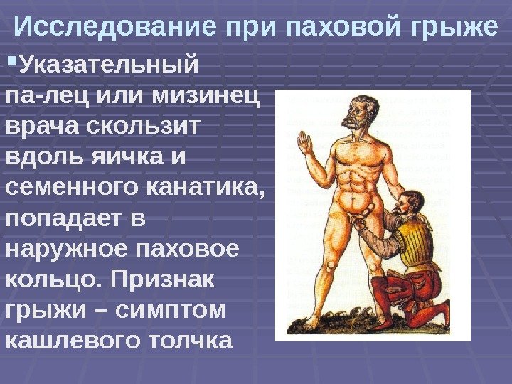 Исследование при паховой грыже Указательный па-лец или мизинец врача скользит вдоль яичка и семенного