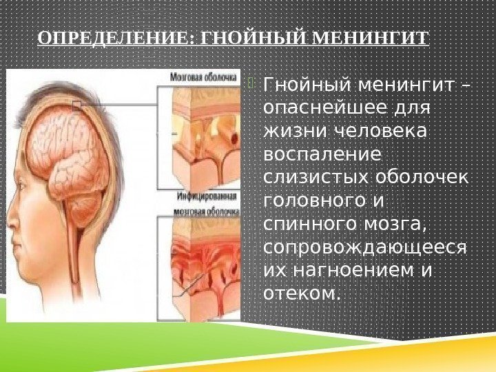 ОПРЕДЕЛЕНИЕ: ГНОЙНЫЙ МЕНИНГИТ Гнойный менингит – опаснейшее для жизни человека воспаление слизистых оболочек головного