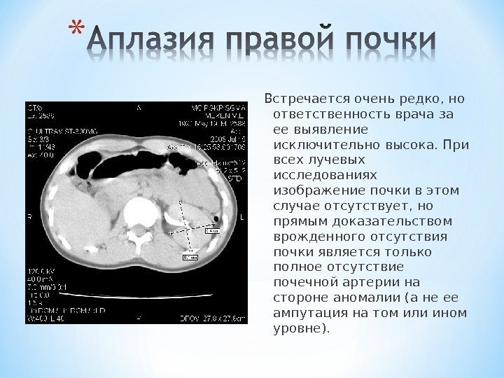 Встречается очень редко, но ответственность врача за ее выявление исключительно высока. При всех лучевых