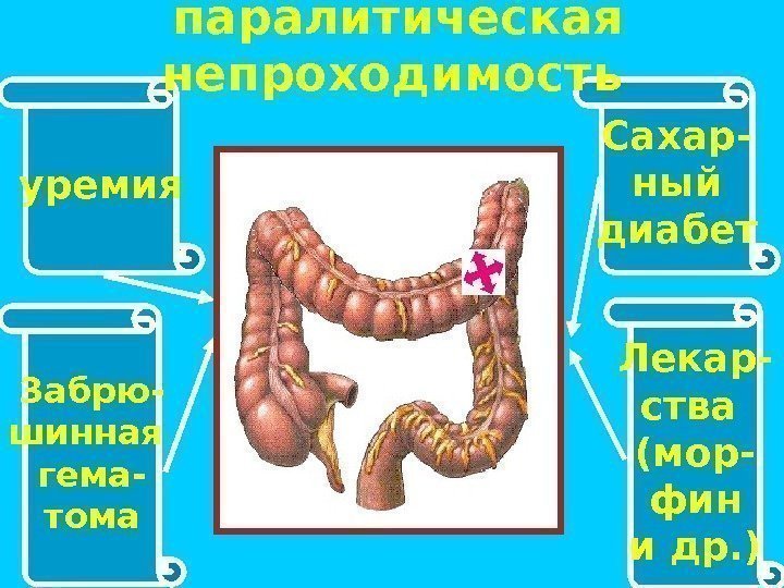 уремия Лекар- ства (мор- фин и др. )Забрю- шинная гема- тома Сахар- ный диабет