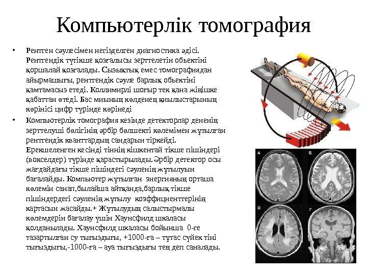 Компьютерлік томография • Рентген с улесімен негізделген диагностика дісі. ә ә Рентгендік т тікше