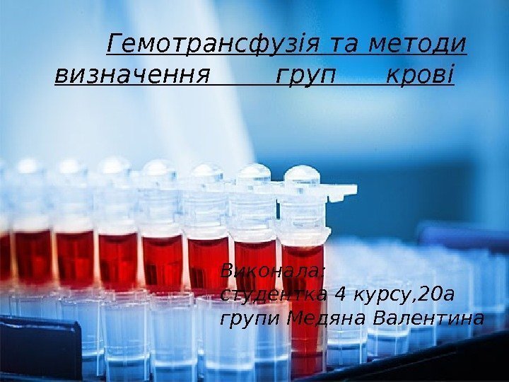    Гемотрансфузія та методи визначення  груп крові Виконала: студентка 4 курсу,