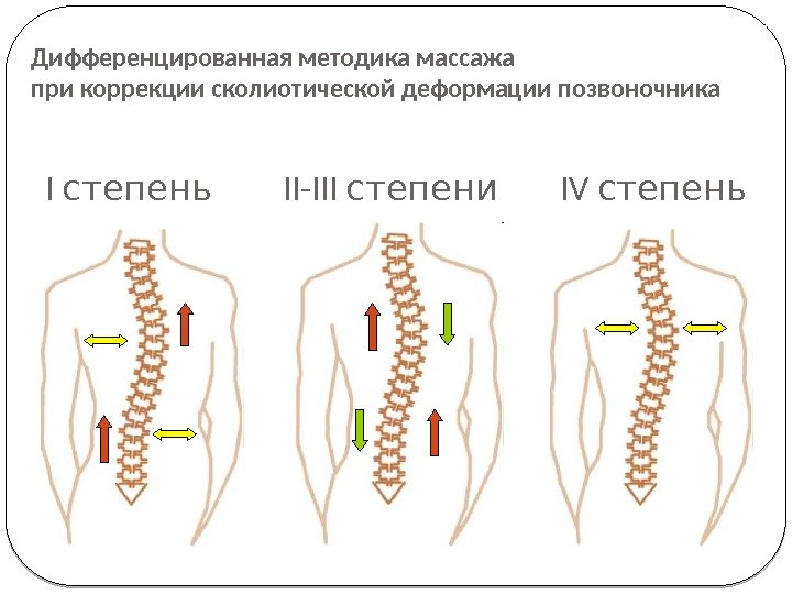 I степень II-III степени IV степень. Дифференцированная методика массажа при коррекции сколиотической деформации позвоночника