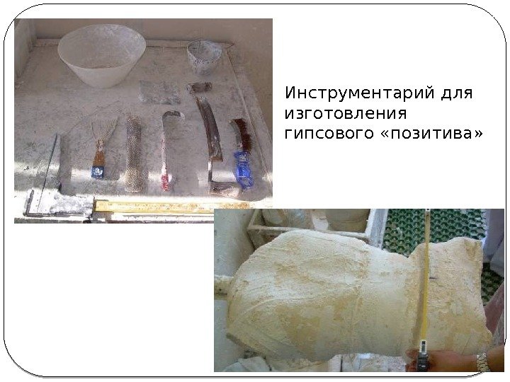 Инструментарий для изготовления гипсового «позитива»  