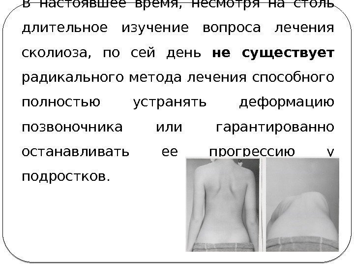 В настоявшее время,  несмотря на столь длительное изучение вопроса лечения сколиоза,  по