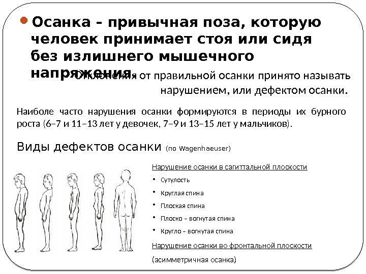  Осанка – привычная поза, которую человек принимает стоя или сидя без излишнего мышечного