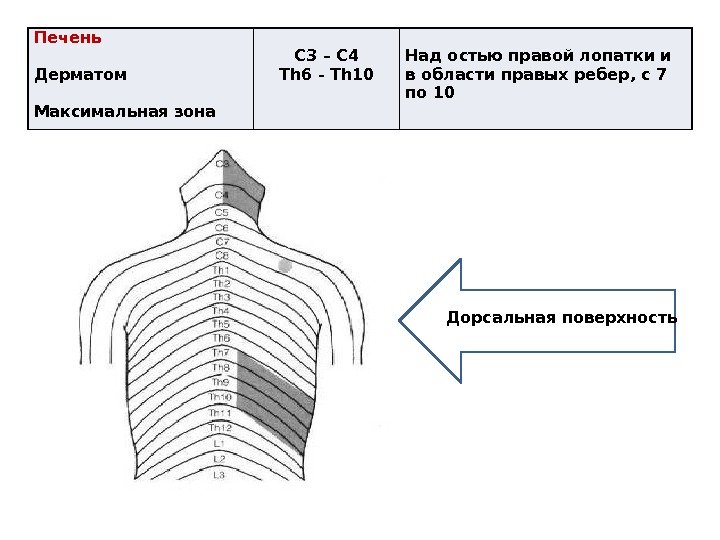 Печень Дерматом Максимальная зона C 3 – С 4 Th 6 - Th 10