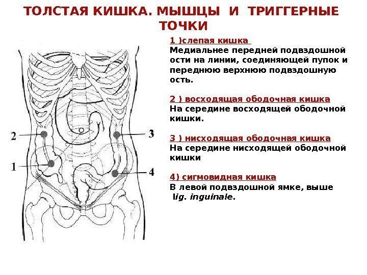 ТОЛСТАЯ КИШКА. МЫШЦЫ И ТРИГГЕРНЫЕ  ТОЧКИ 1 )слепая кишка Медиальнее передней подвздошной ости