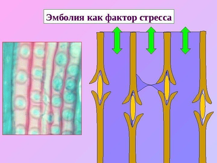   Эмболия как фактор стресса 