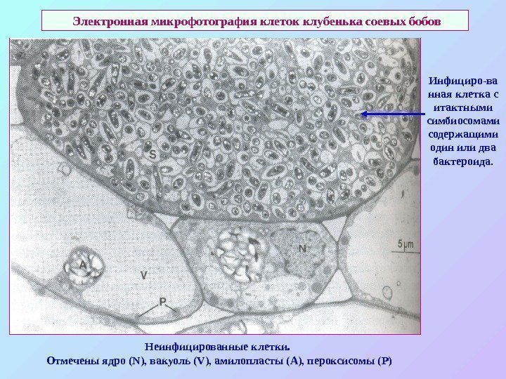  Электронная микрофотография клеток клубенька соевых бобов Инфициро - ва нная клетка с итактными
