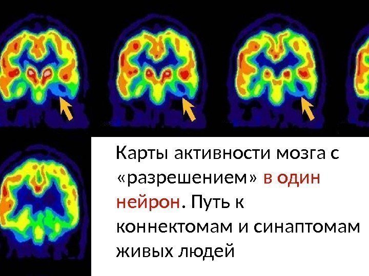 Карты активности мозга с  «разрешением»  в один нейрон. Путь к коннектомам и