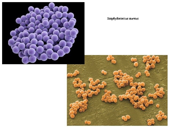 Staphylococcus aureus 