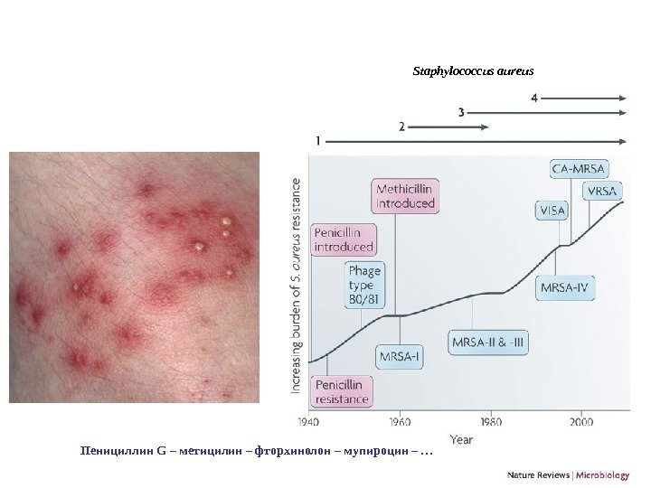 Staphylococcus aureus Пенициллин G – метицилин – фторхинолон – мупироцин – … 