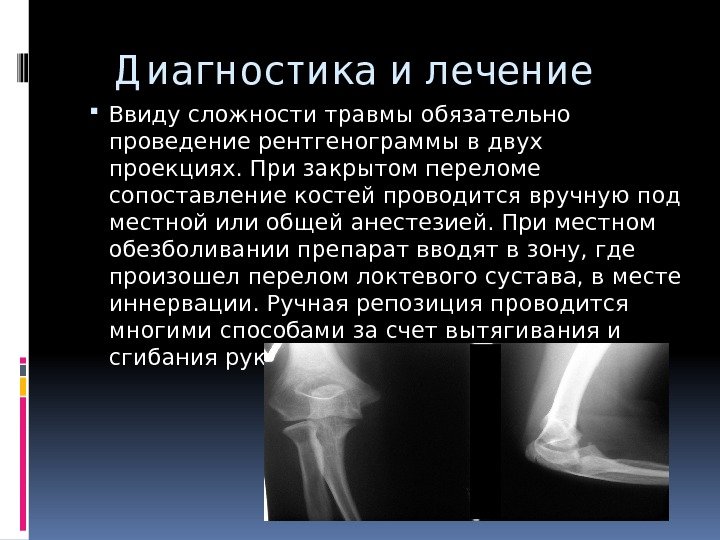  Д иагностика и лечение Ввиду сложности травмы обязательно проведение рентгенограммы в двух