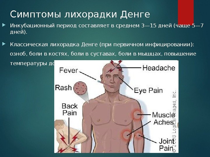 Симптомы лихорадки Денге Инкубационный период составляет в среднем 3— 15 дней (чаще 5— 7