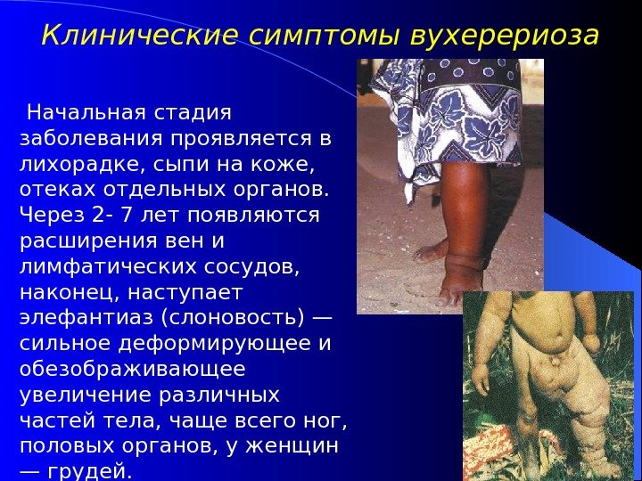   Начальная стадия заболевания проявляется в лихорадке, сыпи на коже,  отеках отдельных