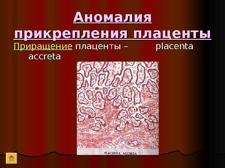 Аномалия прикрепления плаценты Приращение плаценты –   placenta accreta    