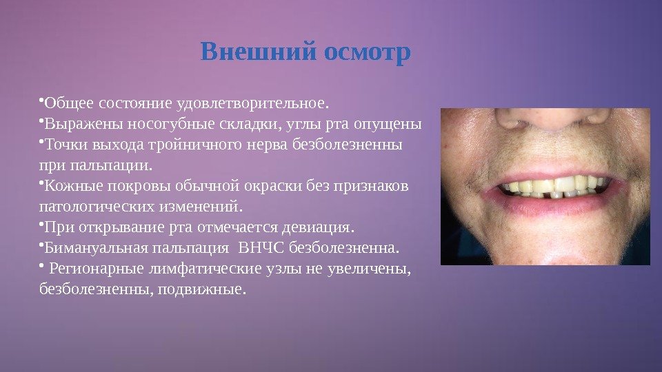 Внешний осмотр • Общее состояние удовлетворительное.  • Выражены носогубные складки, углы рта опущены